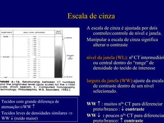 Escala de cinza
                                          A escala de cinza é ajustada por dois
                                             controles:controle de nível e janela.
                                          Manipular a escala de cinza significa
                                                        escala de cinza significa
                                             alterar o contraste

                                          nível da janela (WL): n0 CT intermediário
                                                                n0
                                             ou central dentro do “range” de
                                             densidade do tecido de interesse

                                          largura da janela (WW):ajuste da escala
                                                     janela (WW):ajuste escala
                                              de contraste dentro de um nível
                                              selecionado.

Tecidos com grande diferença de
                                          WW ↑ : muitos n0s CT para diferenciar
                                                          0s
atenuação⇒WW ↑
                                           preto/branco : ↓ contraste
Tecidos leves de densidades similares ⇒
                                          WW ↓ : poucos n0s CT para diferenciar
                                                           0s
WW ↓ (ruído maior)
                                           preto/branco: ↑ contraste
 