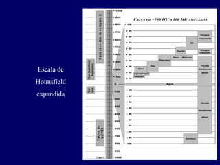 Escala de
Hounsfield
expandida
 