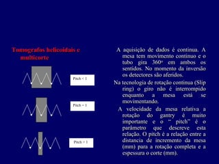 Tomografos helicoidais e          A aquisição de dados é continua. A
                                  A aquisição de dados é continua. A
  multicorte                        mesa tem movimento continuo e o
                                     mesa tem movimento continuo e o
                                    tubo gira 360o em ambos os
                                     tubo gira 360o em ambos os
                                    sentidos. No momento da inversão
                                     sentidos. No momento da inversão
                                    os detectores são aferidos.
                                     os detectores são aferidos.
                     Pitch < 1
                                 Na tecnologia de rotação continua (Slip
                                 Na tecnologia de rotação continua (Slip
                                    ring) o giro não é interrompido
                                     ring) o giro não é interrompido
                                    enquanto a mesa está se
                                     enquanto a mesa está se
                                    movimentando.
                                     movimentando.
                     Pitch = 1
                                  A velocidade da mesa relativa a
                                   A velocidade da mesa relativa a
                                    rotação do gantry é muito
                                     rotação do gantry é muito
                                    importante e o “ pitch” é o
                                     importante e o “ pitch” é o
                                    parâmetro que descreve esta
                                     parâmetro que descreve esta
                                    relação. O pitch é a relação entre a
                                     relação. O pitch é a relação entre a
                     Pitch > 1      distancia de incremento da mesa
                                     distancia de incremento da mesa
                                    (mm) para a rotação completa e a
                                     (mm) para a rotação completa e a
                                    espessura o corte (mm).
                                     espessura o corte (mm).
 