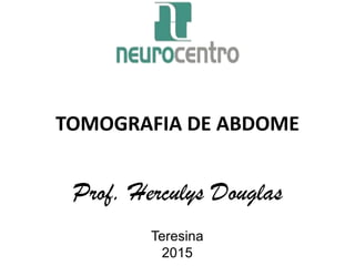 TOMOGRAFIA DE ABDOME
Prof. Herculys Douglas
Teresina
2015
 