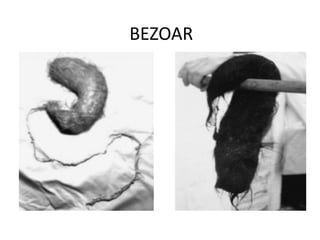 BEZOAR
 