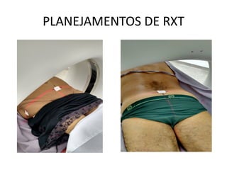 PLANEJAMENTOS DE RXT
 