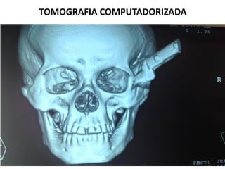 TOMOGRAFIA COMPUTADORIZADA
 