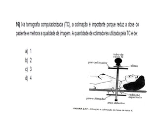 Tomografia do Abdome 