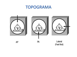 TOPOGRAMA
 