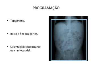 PROGRAMAÇÃO
• Topograma.
• Início e fim dos cortes.
• Orientação: caudocranial
ou craniocaudal.
 