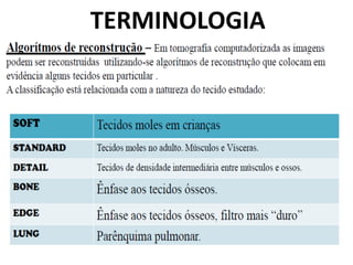 TERMINOLOGIA
 