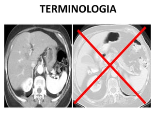 TERMINOLOGIA
 