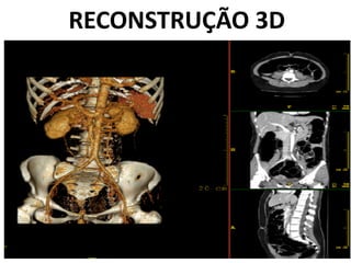 RECONSTRUÇÃO 3D
 