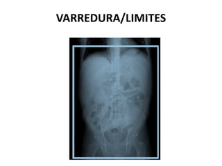 VARREDURA/LIMITES
 