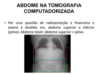 ABDOME NA TOMOGRAFIA
COMPUTADORIZADA
• Por uma questão de radioproteção e financeira o
exame é dividido em, abdome superior e inferior
(pelve). Abdome total= abdome superior + pelve.
 