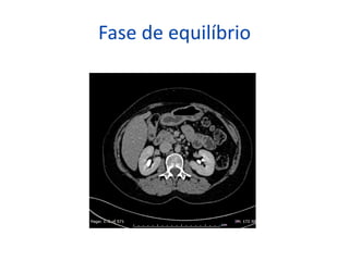 Fase de equilíbrio
 