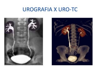 UROGRAFIA X URO-TC
 