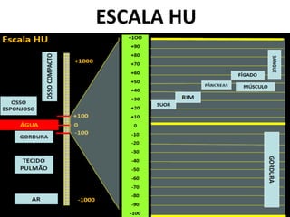 ESCALA HU
 