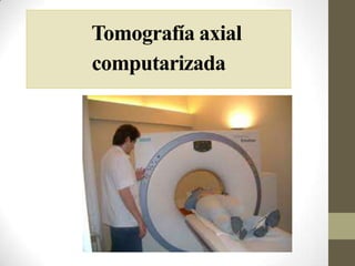 Tomografía axial                    computarizada 
