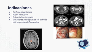 Indicaciones
● Conﬁrma diagnósticos
● Mayor resolución
● Guía estudios invasivos
● captaciones patológicas de los tumores
y otros procesos inﬂamatorios
 