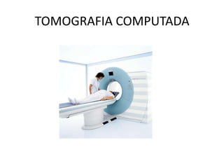 TOMOGRAFIA COMPUTADA
 