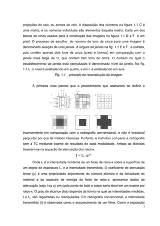projeções do raio, ou somas do raio. A disposição dos números na figura 1.1 C é
uma matriz, e os números individuais são elementos daquela matriz. Cada um dos
blocos de cinza usados para a construção das imagens na figura 1.1 D a F é um
pixel. O processo de escolha do número de tons de cinza para uma imagem é
denominado seleção de uma janela. A largura da janela na fig. 1.1 E e F , é estreita,
pois contém apenas dois tons de cinza (preto e branco) em comparação com a
janela mais larga de D, que contém três tons de cinza. O número no qual o
estabelecimento da janela está centralizado é denominado nível da janela. Na fig.
1.1 E, o nível é estabelecido em quatro, e em F é estabelecido em seis.
                      Fig. 1.1 – princípio da reconstrução da imagem


      À primeira vista parece que o procedimento que acabamos de definir é




inconveniente em comparação com a radiografia convencional, e não é irracional
perguntar por que tal método interessa. Portanto, é instrutivo comparar a radiografia
com a TC mediante exame do resultado de cada modalidade. Ambas as técnicas
baseiam-se na equação de atenuação dos raios-x
                                     I = Io . e-µL
      Onde Io é a intensidade incidente de um feixe de raios-x sobre a superfície de
um objeto de espessura L, e a intensidade transmitida. O coeficiente de atenuação
linear (µ) é uma propriedade dependente do número atômico e da densidade do
material e do espectro de energia do feixe de raios-x. apresentar dados de
atenuação (seja I ou µ) em cada ponto de todo o corpo seria ideal em um exame por
raios-x. O grau de alcance disto depende da forma na qual as intensidades medidas,
I e Io, são registradas ou manipuladas. Em radiografia convencional, a intensidade
transmitida (I) é observada como o escurecimento de um filme. Como a exposição
                                                                             7
 