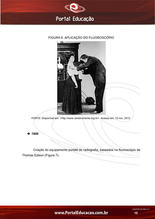 AN02FREV001/REV 4.0
10
FIGURA 6. APLICAÇÃO DO FLUOROSCÓPIO
FONTE: Disponível em: <http://www.cerebromente.org.br>. Acesso em: 12 nov. 2012.
 1900
Criação do equipamento portátil de radiografia, baseados no fluoroscópio de
Thomas Edison (Figura 7).
 