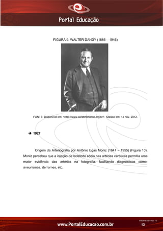 AN02FREV001/REV 4.0
13
FIGURA 9. WALTER DANDY (1886 – 1946)
FONTE: Disponível em: <http://www.cerebromente.org.br>. Acesso em: 12 nov. 2012.
 1927
Origem da Arteriografia por Antônio Egas Moniz (1847 – 1955) (Figura 10).
Moniz percebeu que a injeção de iodetode sódio nas artérias caróticas permitia uma
maior evidência das artérias na fotografia, facilitando diagnósticos como:
aneurismas, derrames, etc.
 