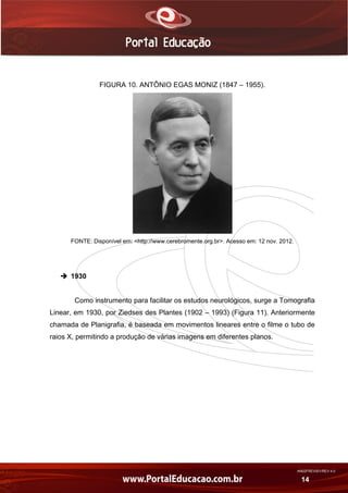 AN02FREV001/REV 4.0
14
FIGURA 10. ANTÔNIO EGAS MONIZ (1847 – 1955).
FONTE: Disponível em: <http://www.cerebromente.org.br>. Acesso em: 12 nov. 2012.
 1930
Como instrumento para facilitar os estudos neurológicos, surge a Tomografia
Linear, em 1930, por Ziedses des Plantes (1902 – 1993) (Figura 11). Anteriormente
chamada de Planigrafia, é baseada em movimentos lineares entre o filme o tubo de
raios X, permitindo a produção de várias imagens em diferentes planos.
 