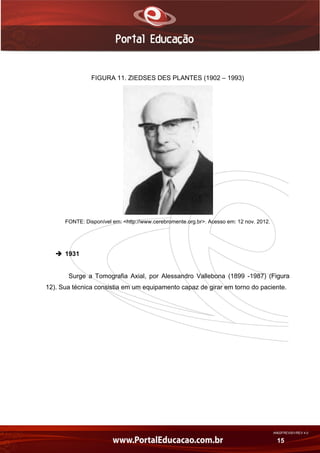 AN02FREV001/REV 4.0
15
FIGURA 11. ZIEDSES DES PLANTES (1902 – 1993)
FONTE: Disponível em: <http://www.cerebromente.org.br>. Acesso em: 12 nov. 2012.
 1931
Surge a Tomografia Axial, por Alessandro Vallebona (1899 -1987) (Figura
12). Sua técnica consistia em um equipamento capaz de girar em torno do paciente.
 