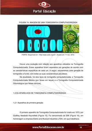 AN02FREV001/REV 4.0
18
FIGURA 14. IMAGEM DE UMA TOMOGRAFIA COMPUTADORIZADA
FONTE: Disponível em: <http://www.acbo.org.br>. Acesso em: 11 nov. 2012.
Houve uma evolução com relação aos aparelhos utilizados na Tomografia
Computadorizada. Esses aparelhos foram separados por gerações de acordo com
as características específicas de cada um. A seguir, estudaremos cada geração de
tomógrafos a fundo, com todas as suas características peculiares.
Na atualidade, há dois tipos de tomografia computadorizada: a Tomografia
Computadorizada Médica (por feixes em leque) e a Tomografia Computadorizada
Odontológica (por feixes cônicos).
1.2OS APARELHOS DE TOMOGRAFIA COMPUTADORIZADA
1.2.1 Aparelhos de primeira geração
O primeiro aparelho de Tomografia Computadorizada foi criado em 1972, por
Godfrey Newbold Hounsfield (Figura 15). Foi denominado de EMI (Figura 16), em
homenagem a empresa Eletric and Musical Industries LTDA, em que trabalhava.
 