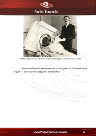 AN02FREV001/REV 4.0
20
FONTE: Disponível em: <http://www.cerebromente.org.br>. Acesso em: 12 nov. 2012.
Utilizados apenas para exames craniais, os tomógrafos da Primeira Geração
(Figura 17) apresentavam as seguintes características:
 