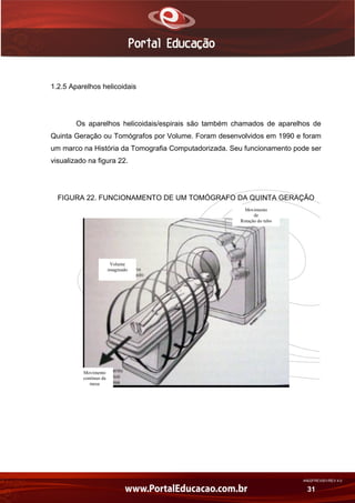AN02FREV001/REV 4.0
31
1.2.5 Aparelhos helicoidais
Os aparelhos helicoidais/espirais são também chamados de aparelhos de
Quinta Geração ou Tomógrafos por Volume. Foram desenvolvidos em 1990 e foram
um marco na História da Tomografia Computadorizada. Seu funcionamento pode ser
visualizado na figura 22.
FIGURA 22. FUNCIONAMENTO DE UM TOMÓGRAFO DA QUINTA GERAÇÃO
Movimento
de
Rotação do tubo
Volume
imaginado
Movimento
contínuo da
mesa
 