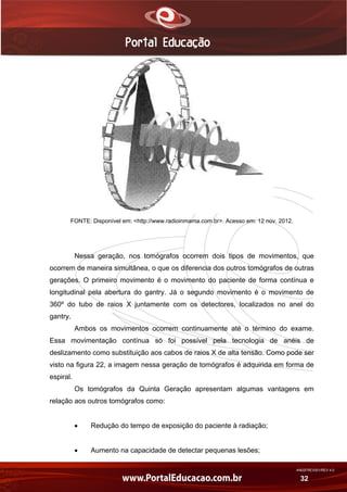 AN02FREV001/REV 4.0
32
FONTE: Disponível em: <http://www.radioinmama.com.br>. Acesso em: 12 nov. 2012.
Nessa geração, nos tomógrafos ocorrem dois tipos de movimentos, que
ocorrem de maneira simultânea, o que os diferencia dos outros tomógrafos de outras
gerações. O primeiro movimento é o movimento do paciente de forma contínua e
longitudinal pela abertura do gantry. Já o segundo movimento é o movimento de
360º do tubo de raios X juntamente com os detectores, localizados no anel do
gantry.
Ambos os movimentos ocorrem continuamente até o término do exame.
Essa movimentação contínua só foi possível pela tecnologia de anéis de
deslizamento como substituição aos cabos de raios X de alta tensão. Como pode ser
visto na figura 22, a imagem nessa geração de tomógrafos é adquirida em forma de
espiral.
Os tomógrafos da Quinta Geração apresentam algumas vantagens em
relação aos outros tomógrafos como:
 Redução do tempo de exposição do paciente à radiação;
 Aumento na capacidade de detectar pequenas lesões;
 