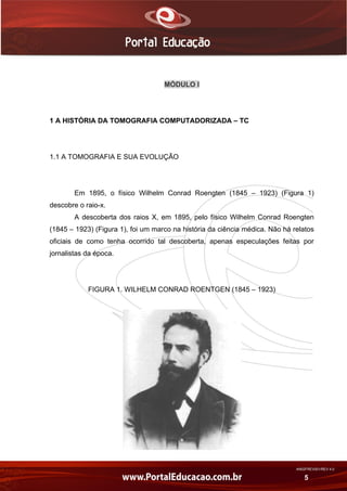 AN02FREV001/REV 4.0
5
MÓDULO I
1 A HISTÓRIA DA TOMOGRAFIA COMPUTADORIZADA – TC
1.1 A TOMOGRAFIA E SUA EVOLUÇÃO
Em 1895, o físico Wilhelm Conrad Roengten (1845 – 1923) (Figura 1)
descobre o raio-x.
A descoberta dos raios X, em 1895, pelo físico Wilhelm Conrad Roengten
(1845 – 1923) (Figura 1), foi um marco na história da ciência médica. Não há relatos
oficiais de como tenha ocorrido tal descoberta, apenas especulações feitas por
jornalistas da época.
FIGURA 1. WILHELM CONRAD ROENTGEN (1845 – 1923)
 