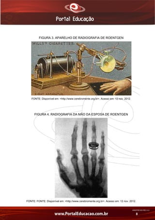 AN02FREV001/REV 4.0
8
FIGURA 3. APARELHO DE RADIOGRAFIA DE ROENTGEN
FONTE: Disponível em: <http://www.cerebromente.org.br>. Acesso em: 12 nov. 2012.
FIGURA 4. RADIOGRAFIA DA MÃO DA ESPOSA DE ROENTGEN
FONTE: FONTE: Disponível em: <http://www.cerebromente.org.br>. Acesso em: 12 nov. 2012.
 