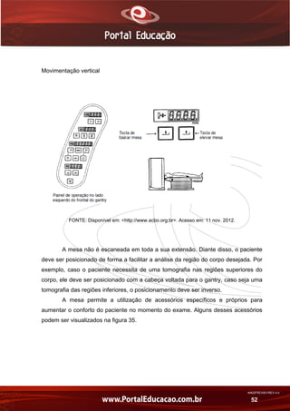 AN02FREV001/REV 4.0
52
Movimentação vertical
FONTE: Disponível em: <http://www.acbo.org.br>. Acesso em: 11 nov. 2012.
A mesa não é escaneada em toda a sua extensão. Diante disso, o paciente
deve ser posicionado de forma a facilitar a análise da região do corpo desejada. Por
exemplo, caso o paciente necessita de uma tomografia nas regiões superiores do
corpo, ele deve ser posicionado com a cabeça voltada para o gantry, caso seja uma
tomografia das regiões inferiores, o posicionamento deve ser inverso.
A mesa permite a utilização de acessórios específicos e próprios para
aumentar o conforto do paciente no momento do exame. Alguns desses acessórios
podem ser visualizados na figura 35.
 