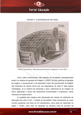AN02FREV001/REV 4.0
65
FIGURA 41. ILUSTRAÇÃO DE UM VOXEL
FONTE: Disponível em: <http://www.quenerd.com.br>. Acesso em: 13 nov. 2012.
Como citado anteriormente, todo aparelho de tomografia computadorizada
possui um sistema de geração de imagens, o PACS. Há dois sistemas de geração
de imagens: o convencional e o de impressão a laser. No convencional, as imagens
são impressas da mesma forma que nos diagnósticos de raios X, pela mesma
metodologia. Já no sistema de impressão a laser, selecionam-se as imagens de
forma organizada e essas são diretamente encaminhadas à impressora, sendo
impressas em papel próprio.
A qualidade das imagens está relacionada aos valores do coeficiente de
atenuação dos raios X (UH – Unidade de Hounsfield). Cada componente do corpo
humano apresenta uma faixa de UH característica, como pode ser observado na
tabela 1. Porém, esse valor vai depender da estrutura onde se encontra tal
 