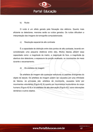 AN02FREV001/REV 4.0
67
b) Ruído
O ruído é um efeito gerado pela flutuação dos elétrons. Quanto mais
eficiente os detectores, menores serão os ruídos gerados. Os ruídos dificultam a
interpretação das imagens de tomografia computadorizada.
c) Resolução espacial de alto contraste
É a capacidade de distinção entre dois pontos de alto contraste, levando em
consideração uma pequena distância entre eles. Muitos fatores afetam essa
capacidade como: a magnitude da matriz, a magnitude do foco, a magnitude da
abertura dos detectores, a espessura da porção analisada, os movimentos de mesa
durante o escaneamento.
d) Os artefatos de imagem
Os artefatos de imagem são quaisquer estruturas ou padrões divergentes do
objeto de estudo. Os artefatos de imagem podem ser causados por uma infinidade
de fatores, os principais são: artefatos de movimento, causados tanto por
movimentos voluntários (Figura 42 A) quanto por movimentos involuntários do corpo
humano (Figura 42 B) e os artefatos de alta atenuação (Figura 43), como obturações
dentárias e outros objetos.
 