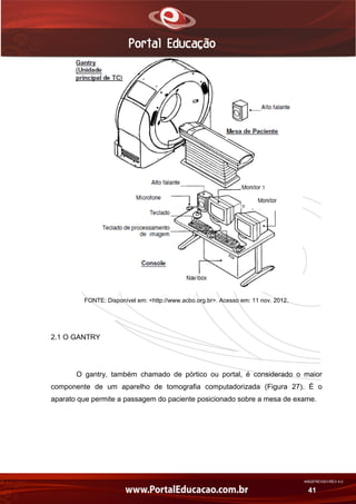 AN02FREV001/REV 4.0
41
FONTE: Disponível em: <http://www.acbo.org.br>. Acesso em: 11 nov. 2012.
2.1 O GANTRY
O gantry, também chamado de pórtico ou portal, é considerado o maior
componente de um aparelho de tomografia computadorizada (Figura 27). É o
aparato que permite a passagem do paciente posicionado sobre a mesa de exame.
 
