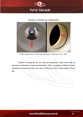 AN02FREV001/REV 4.0
42
FIGURA 27. GANTRY DO TOMÓGRAFO
FONTE: Disponível em: <http://www.acbo.org.br>. Acesso em: 11 nov. 2012.
O gantry é constituído por um anel que representa o local onde estão os
sensores ou detectores (cristais luminescentes - NAL) e o gerador de feixes, também
chamado de ampola de feixes, por onde os feixes de raios X são emitidos (Figura
28).
 