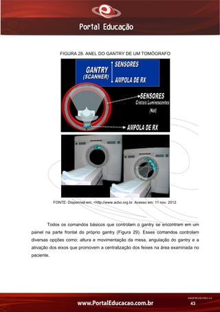 AN02FREV001/REV 4.0
43
FIGURA 28. ANEL DO GANTRY DE UM TOMÓGRAFO
FONTE: Disponível em: <http://www.acbo.org.br. Acesso em: 11 nov. 2012.
Todos os comandos básicos que controlam o gantry se encontram em um
painel na parte frontal do próprio gantry (Figura 29). Esses comandos controlam
diversas opções como: altura e movimentação da mesa, angulação do gantry e a
ativação dos eixos que promovem a centralização dos feixes na área examinada no
paciente.
 