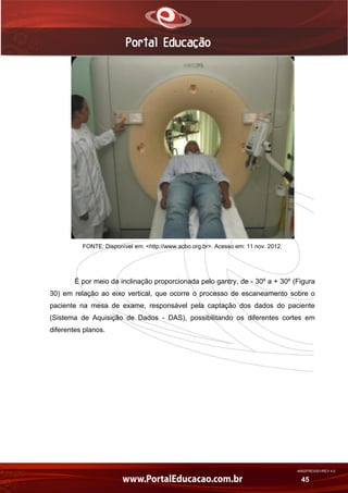 AN02FREV001/REV 4.0
45
FONTE: Disponível em: <http://www.acbo.org.br>. Acesso em: 11 nov. 2012.
É por meio da inclinação proporcionada pelo gantry, de - 30º a + 30º (Figura
30) em relação ao eixo vertical, que ocorre o processo de escaneamento sobre o
paciente na mesa de exame, responsável pela captação dos dados do paciente
(Sistema de Aquisição de Dados - DAS), possibilitando os diferentes cortes em
diferentes planos.
 