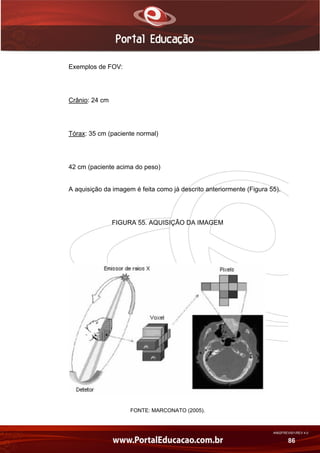 AN02FREV001/REV 4.0
86
Exemplos de FOV:
Crânio: 24 cm
Tórax: 35 cm (paciente normal)
42 cm (paciente acima do peso)
A aquisição da imagem é feita como já descrito anteriormente (Figura 55).
FIGURA 55. AQUISIÇÃO DA IMAGEM
FONTE: MARCONATO (2005).
 