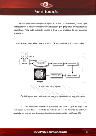 AN02FREV001/REV 4.0
87
A reconstrução das imagens (Figura 56) é feita por meio de algoritmos, que
correspondem a recursos matemáticos realizados por programas computacionais
específicos. Para cada indicação médica e área a ser analisada há um algoritmo
apropriado.
FIGURA 56. ESQUEMA DO PROCESSO DE RECONSTRUÇÃO DA IMAGEM
FONTE: MARCONATO (2005).
Os dados para a reconstrução das imagens são obtidos da seguinte forma:
 Os detectores medem a quantidade de raios X que foi capaz de
atravessar o paciente: a quantidade de radiação absorvida depende da estrutura
avaliada, ou seja, da sua densidade (coeficiente de atenuação - µ) (Figura 57).
 