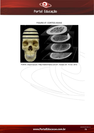 AN02FREV001/REV 4.0
75
FIGURA 47. CORTES AXIAIS
FONTE: Disponível em: <http://radioinmama.com.br>. Acesso em: 10 nov. 2012.
 