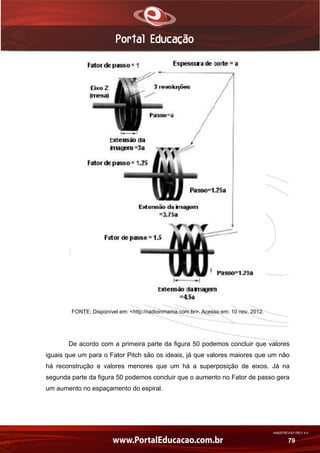 AN02FREV001/REV 4.0
79
FONTE: Disponível em: <http://radioinmama.com.br>. Acesso em: 10 nov. 2012.
De acordo com a primeira parte da figura 50 podemos concluir que valores
iguais que um para o Fator Pitch são os ideais, já que valores maiores que um não
há reconstrução e valores menores que um há a superposição de eixos. Já na
segunda parte da figura 50 podemos concluir que o aumento no Fator de passo gera
um aumento no espaçamento do espiral.
 