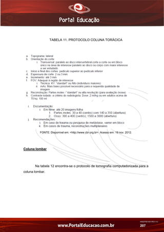 AN02FREV001/REV 4.0
207
TABELA 11. PROTOCOLO COLUNA TORÁCICA
FONTE: Disponível em: <http://www.cbr.org.br>. Acesso em: 19 nov. 2012.
Coluna lombar
Na tabela 12 encontra-se o protocolo de tomografia computadorizada para a
coluna lombar.
 