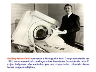 Godfrey Hounsfield apresento a Tomografía Axial Computadorizada em
1972, como um método de diagnostico, basado na formação de raios X,
cujas imágenes são captadas por um computador, obtendo dessa
forma imágenes digitais.
 