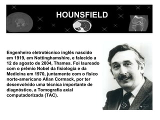 HHOUNSFIELD



Engenheiro eletrotécnico inglês nascido
em 1919, em Nottinghamshire, e falecido a
12 de agosto de 2004, Thames. Foi laureado
com o prêmio Nobel da fisiologia e da
Medicina em 1970, juntamente com o físico
norte-americano Allan Cormack, por ter
desenvolvido uma técnica importante de
diagnóstico, a Tomografia axial
computadorizada (TAC).
 