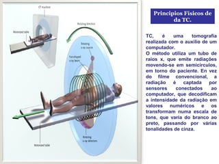 Principios Físicos de
          da TC.

TC,    é    uma    tomografía
realizada com o auxilio de um
computador.
O método utiliza um tubo de
raios x, que emite radiações
movendo-se em semicirculos,
em torno do paciente. En vez
do filme convencional, a
radiação    é   captada    por
sensores     conectados     ao
computador, que decodificam
a intensidade da radiação em
valores numéricos e os
transformam numa escala de
tons, que varia do branco ao
preto, passando por várias
tonalidades de cinza.
 