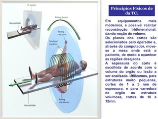 Principios Físicos de
          da TC.
Em      equipamentos      mais
modernos, é possivel realizar
reconstrução tridimensional,
dando noção de volume.
Os planos dos cortes são
selecionados pelo operador e,
através do computador, move-
se a mesa onde está o
paciente, de modo a examinar
as regiões desejadas.
A espessura do corte é
escolhida de acordo com o
volume do orgão ou lesão a
ser analisada. Utilizamos, para
estruturas muito pequenas,
cortes de 1 a 5 mm de
espessura, e para varredura
de    orgão     ou    estrutura
volumosa, cortes de 10 a
12mm.
 