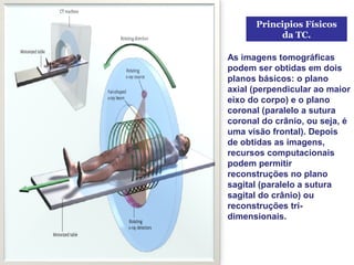 Principios Físicos
           da TC.

As imagens tomográficas
podem ser obtidas em dois
planos básicos: o plano
axial (perpendicular ao maior
eixo do corpo) e o plano
coronal (paralelo a sutura
coronal do crânio, ou seja, é
uma visão frontal). Depois
de obtidas as imagens,
recursos computacionais
podem permitir
reconstruções no plano
sagital (paralelo a sutura
sagital do crânio) ou
reconstruções tri-
dimensionais.
 