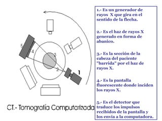 1.- Es un generador de
rayos X que gira en el
sentido de la flecha.


2.- Es el haz de rayos X
generado en forma de
abanico.


3.- Es la sección de la
cabeza del paciente
"barrida" por el haz de
rayos X.


4.- Es la pantalla
fluorescente donde inciden
los rayos X.


5.- Es el detector que
traduce los impulsos
recibidos de la pantalla y
los envía a la computadora.
 